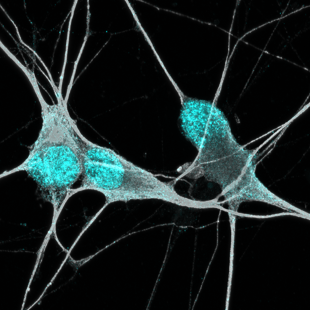 Fluorescent microscopy image of neurons used in personalized ALS disease modeling at SUI Health